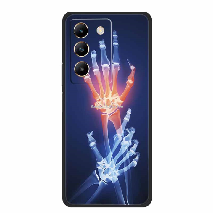 Asinrn%20ERosIon%20For%20Vivo%20Y200e%20Case%20Y%20200%20e%20Phone%20Cover%20Black%20Silicone%20Soft%20Phone%20Case%20For%20Vivo%20Y200e%20Back%20Cover%20Case%20Y%20200e%20Y200%20e%20Coque%206.67%20-%20Image%202