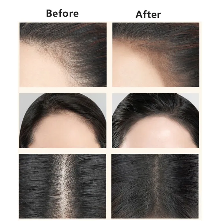 YZE%20Beauty%20Hairline%20Powder%20For%20Hair%20Root%20Touch-Up%20with%20Applicator,%20For%20Men%20and%20Women,%20(Black)%20%204.5gm%20-%20Image%202