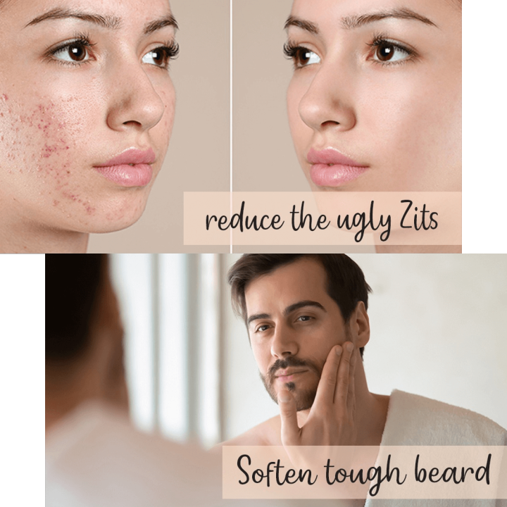 Boroline%20Ayurvedic%20Antiseptic%20Cream%20%7C%20100g%20Jumbo%20Pack%20%7C%20Perfect%20All%20Rounder%20Cream%20-%20Image%205