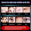 Anti-Aging Eye Massager Red Light Therapy Hot Compress Eyes Fatigue Relief Relaxation Relieve Dark Circles EMS Eye Care Massage. 