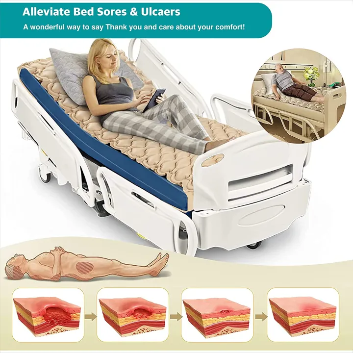Ambitech%20Anti-Decubitus%20Anti-Bedsore%20Air%20Mattress%20With%20Compressor%20Alternating%20Pressure%20System%20-%20Air%20Mattress%20%7C%20-%20Image%204