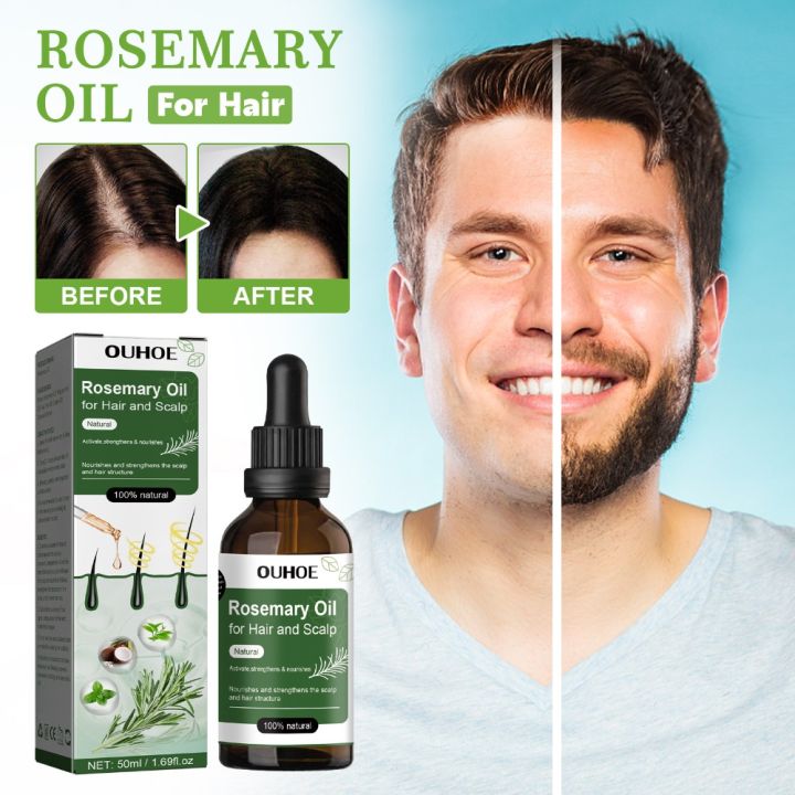 Thickening,%20Hair%20Protection,%20Baldness%20Remedy,%20Anti-Hair%20Loss,%20Rosemary%20Hair%20Growth%20Serum,%20Anti-Prevention,%20Growth%20Promotion,%20Scalp%20Treatment%20-%20Image%202