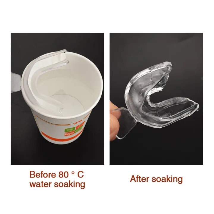 2025%20NEW%20%E3%80%90KuaKe%20Mall%E3%80%91Silicone%20Tooth%20Braces%20Dental%20Teeth%20Whitening%20Tray%20Boxing%20Retainer%20Anti%20Snoring%20Guard%20EVA%20Teeth%20Protector%20-%20Image%207