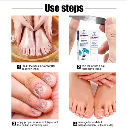 Nail%20Repair%20Cream/20%20gm/dermatology%20inspired%20care/%20-%20Image%204