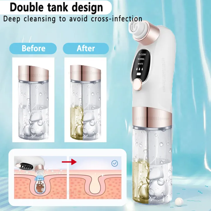Blackhead%20Remover%20Pore%20Vacuum%20Face%20T%20Zone%20Cleaner%20Pimple%20Black%20Head%20Removal%20Electric%20Water%20Cycle%20Facial%20Nose%20Blackhead%20Removal%20-%20Image%205