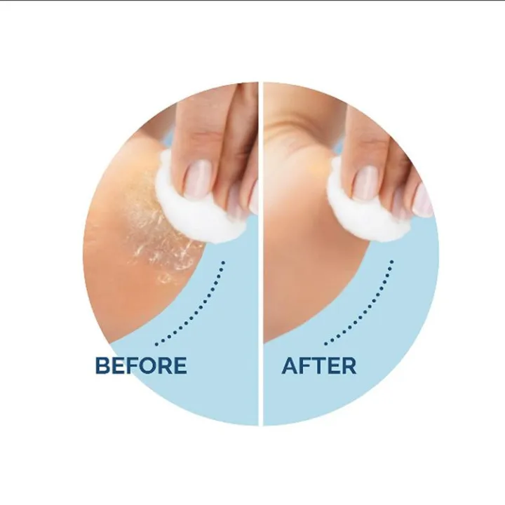 Perfect%20Electric%20Foot%20Pedicure%20Machine%20Professional%20Feet%20Care%20Tools%20Foot%20Dead%20Skin%20Callous%20Remover%20Electronic%20Foot%20Pedicure%20Tool%20-%20Image%204