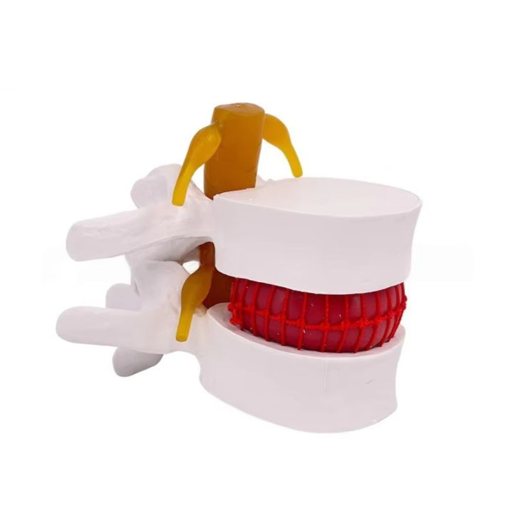 Use%203D%20Model%20Lumbar%20Model%20Compression%20Demonstration%20Spinal%20Pressure%20Lesions%20Human%20Anatomy%20Skeleton%20Model%20Educational%20Tool%20Simulation%20Spine%20Demonstration%20Structure%20Student%20-%20Image%209