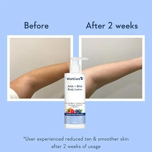 WishCare%2010%25%20AHA%20+%201%25%20BHA%20Body%20Lotion%20-%20Smooths%20Rough%20&%20Bumpy%20Skin%20-%20Glycolic%20&%20Lactic%20Acid%20Body%20Lotion%20with%20Niacinamide%20-%20200%20Ml%20-%20Image%203