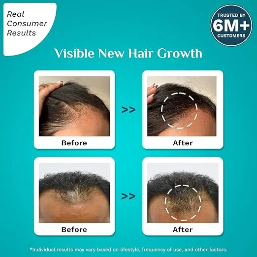 Pilgrim%20Redensyl%203%25%20+%20Anagain%204%25%20Advanced%20Hair%20Growth%20Serum%2030ml%20-%20Image%203