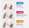 3 In 1 Dental Orthodontic Teeth Corrector Mouth Guard Braces Retainer Straighten Tool. 