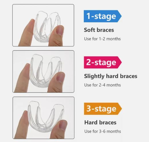 3%20In%201%20Dental%20Orthodontic%20Teeth%20Corrector%20Mouth%20Guard%20Braces%20Retainer%20Straighten%20Tool%20-%20Image%202