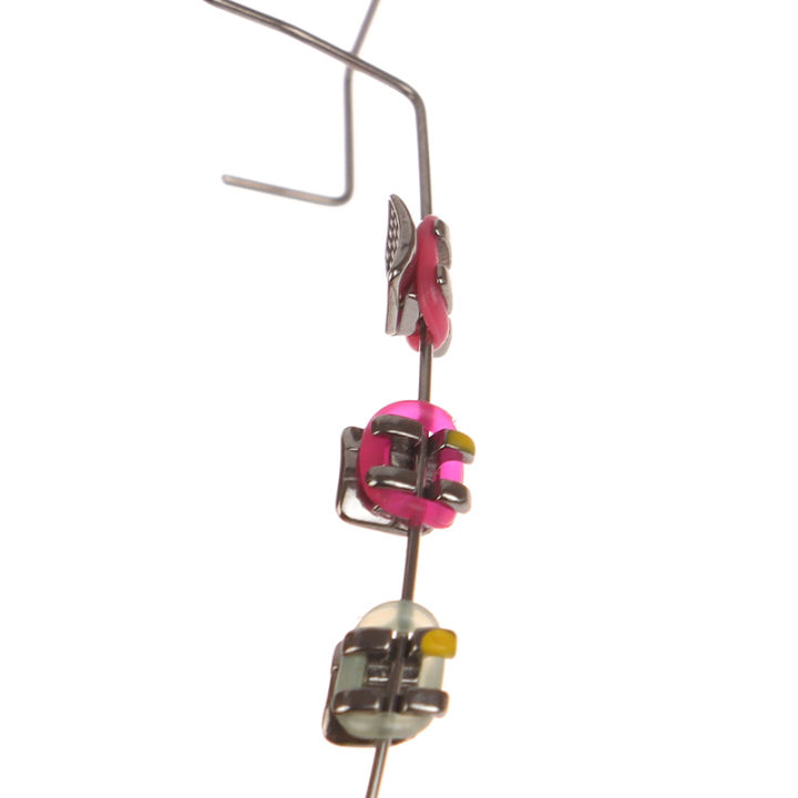 2Pcs%20Dentistry%20Fake%20Brackets%20Braces%20Teeth%20Temporary%20Dental%20Decoration%20Accessories%20Metal%20Wires%20Colorful%20Orthodontic%20Ligature%20Ties%20BOYUAN%20-%20Image%205