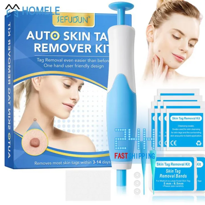 Huangdian%20Profesional%202In1%20Painless%20Auto%20Skin%20Tag%20Mole%20Wart%20Removal%20Kit%20Face%20Skin%20Care%20Body%20Wart%20And%20Dot%20Treatments%20Remover%20Plantar%20Warts%20Corn%20Removal%20-%20Image%202