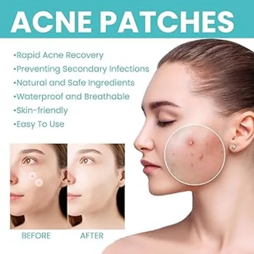 240%20Counts%20Circle%20West%20&%20Month%20Acne%20Patches%20Repairs%20Acne%20Pimples%20Cleans%20Pores%20Invisible%20Breathable%20Concealer%20Waterproof%20pimple%20Patches%20-%20Image%204