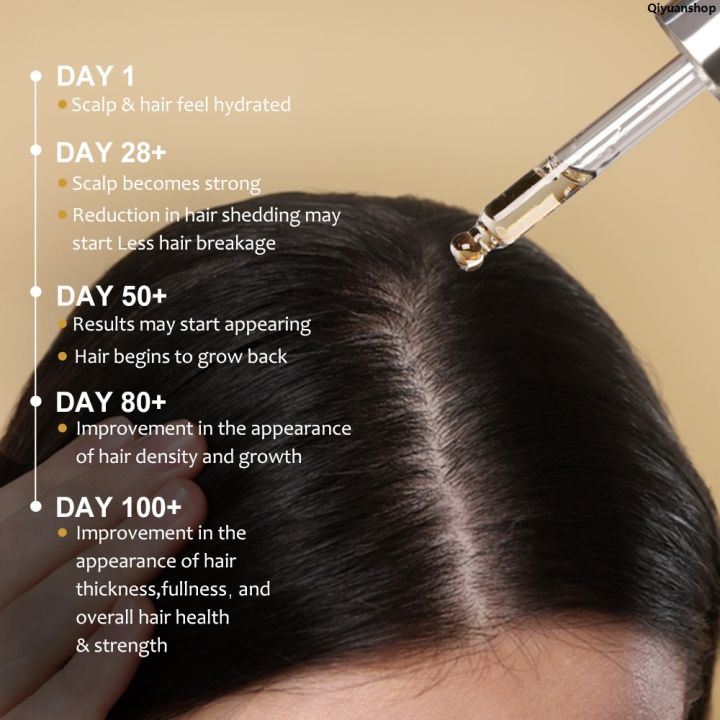 QiyuanshopBargain%20price%20PURC%20Dropshipping%20Ginger%20Extract%20Hair%20Oil%20Products%20For%20Men%20Women%20Regrowth%20Oil%20Hair%20Loss%20Treatment%20Essential%20Hair%20Care%20-%20Image%204