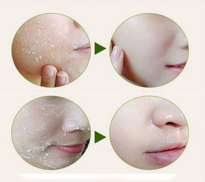 Dr.%20Rashel%20Aloe%20Vera%202%20in%201%20Facial%20Peeling%20&%20Scrub%20100%20gm%20-%20Image%206