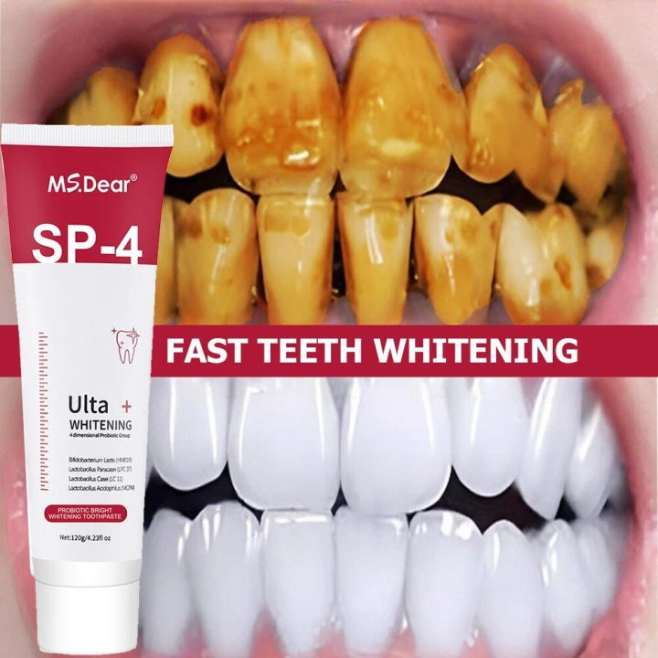 SP4%20Ultra%20Whitening%20Teeth%20%20Color%20Corrector%20Probiotic%20Whitening%20Toothpaste%20Refresh%20Mouth%20Brighten%20Remove%20Yellow%20Teeth%20/%20SP-4%20Teeth%20Whitening%20-%20Image%202