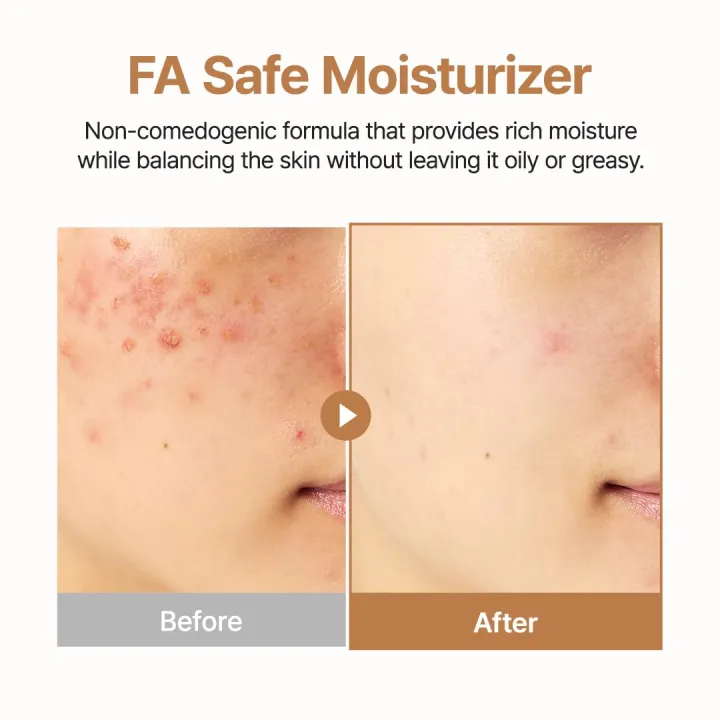 PURITO%20Oat%20In%20Calming%20Gel%20Cream%20%7C%20Soothing%20solution%20for%20Sensitive%20Skin%20%7C%20Lightweight,%20Non-Comedogenic,%20Fragrance-Free,%20Vegan%20&%20Cruelty-free%20%7C%20Korean%20Skincare,%20100mL%203.38%20fl.oz%20-%20Image%208