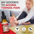 Ingrown Toenail Pain Relief Drops - 30ml. 