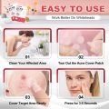200 Patches Acne Cover  Pimple Patches for Face, Hydrocolloid Acne Patches, Cute Star Zit Covers for Face. 