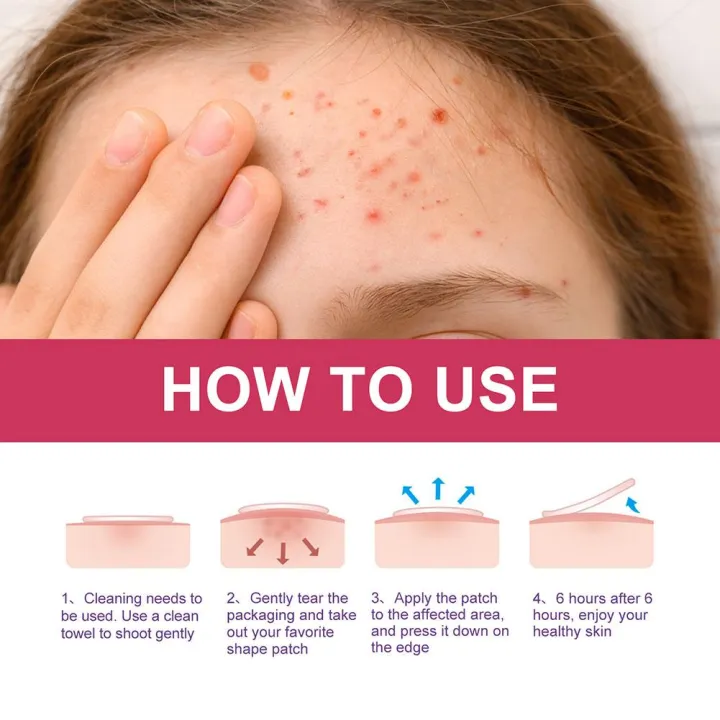 114%20Counts%20Cute%20Bunny%20Animals%20Acne%20Pimple%20Patches%20Cover%20Stickers,%20Invisible%20Face%20Spot%20Pimple%20Concealer%20Makeup%20Tool%20-%20Image%204
