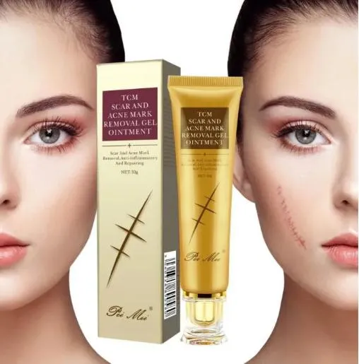 Pei%20Mei%20TCM%20Scar,%20Stretch%20And%20Acne%20Mark%20Removal%20Gel%20Ointment%2030GM%20-%20Image%202