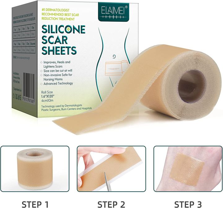 New model 1.5M/3M Scar Removal Patch Surgery Self-Adhesive Silicone Gel Tape Remove Scar Patch Sticker Acne Trauma Burn Scar Skin Care