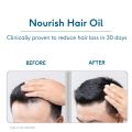 HK VITALS Nourish Hair Oil 100ml with Rosemary Amla Bhringraj | For Hair Growth & Hair Fall Control. 