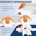 Use 3D Model Lumbar Model Compression Demonstration Spinal Pressure Lesions Human Anatomy Skeleton Model Educational Tool Simulation Spine Demonstration Structure Student. 