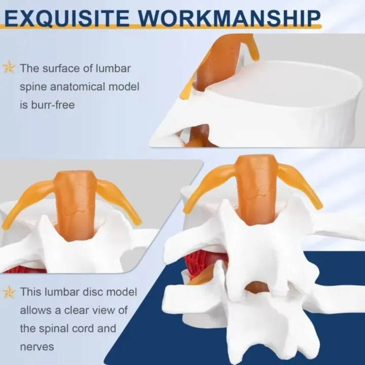 High%20Quality%203D%20Model%20Lumbar%20Model%20Compression%20Demonstration%20.5X%20Enlarge%20Human%20Anatomy%20Skeleton%20Model%20Spinal%20Pressure%20Lesions%20Simulation%20Lumbar%20Disc%20Herniation%20Teaching%20Tool%20Nursing%20-%20Image%207