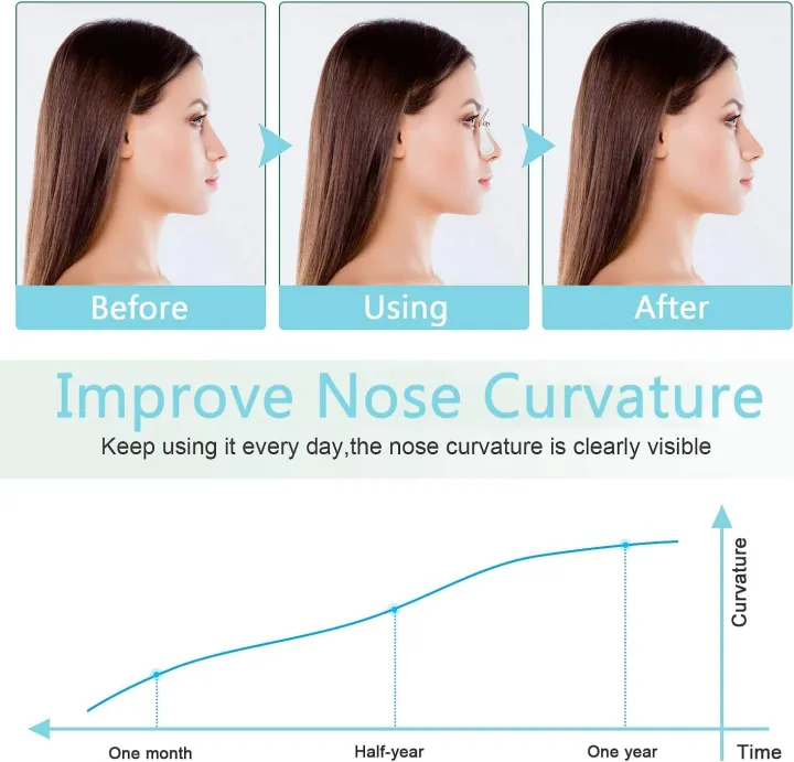 Nose%20Shaper%20Clip%20for%20Nose%20Lifting%20&%20Slimming%20%7C%20Silicone%20Nose%20Up%20Lifter%20Tool%20(Portable%20Size)%20-%20Image%206