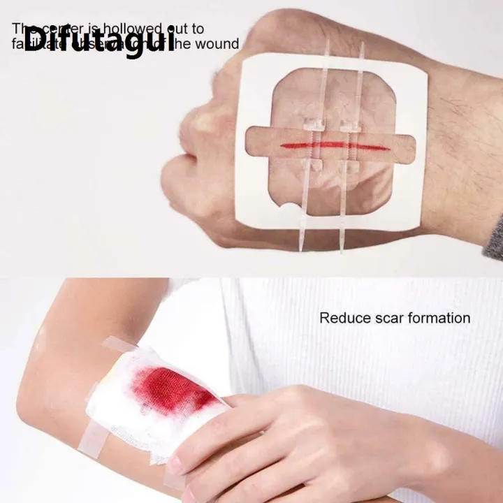 Difutagui%202025%20Zip%20Stitch%20Sutures%206x7cm%20Skin%20Laceration%20Closures%20Adhesive%20Bandages%20Zipper%20Band%20aid%20Patch%20for%20Emergency%20Wound%20Care%20First%20Aids%20-%20Image%204