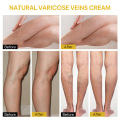Ximonth 60g Bee Venom Skin Smoothing Cream Repair Vein Varicose Promotes Blood Circulation Reduce Spider Veins Leg Care Paste. 