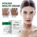Vitiligo Health Cream, Treat Vitiligo Soothing Cream, Vitiligo Treatment Cream, Vitiligo Cream for White Spots On Skin Care, Body Vitiligo Care Cream for Reduce White Spot-2. 