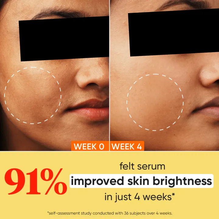 Dot%20&%20Key%2010%25%20Vitamin%20C%20+%20E%20with%205%25%20Niacinamide%20Face%20Serum%2030ml%20-%20Image%203