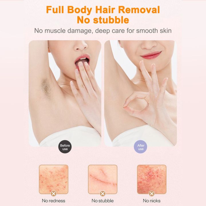 Double%20Head%20Electric%20Shaver%20Lip%20Hair%20Armpit%20Hair%20Shaver%20Private%20Intimate%20Epilator%20Leg%20Hair%20Trimmer%20-%20Image%207