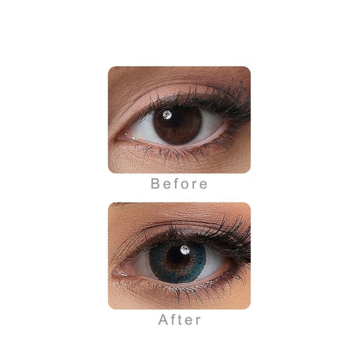 Turquoise%20Color%20Contact%20Lenses%20(Bold%20Green)%20%7C%20Powerless%20Daily%20Wear%20Casual%20Colored%20Contact%20Lens%20%7C%20Zero%20Power%20Contact%20Lens%20-%20Image%202