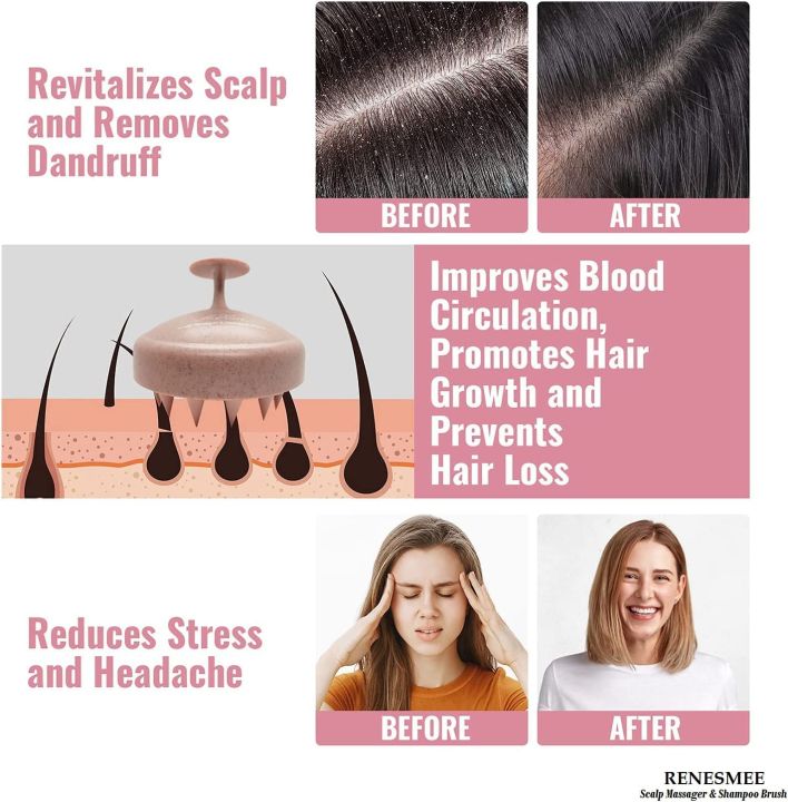 Smart%20Choice%20Scalp%20Massager%20Shampoo%20Brush%20%7C%20Soft%20Silicone%20Bristles%20Hair%20Scrubber%20for%20Dandruff%20Removal%20%7C%20Hair%20Loss%20Prevention%20%7C%20Exfoliating%20Scalp%20Care%20for%20All%20Hair%20Types%20(Multicolor,%20Eco-Friendly)%20-%20Image%204