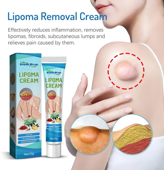 South Moon LumpFree Lipoma Removal Cream And Moisturizers-20g