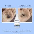 WishCare Hair Growth Serum For Scalp | 94% Saw New Hair Growth | Redensyl & Rosemary Oil | 100% Saw Hairfall Reduction | In-Vivo Tested | For Men & Women | 30ml. 