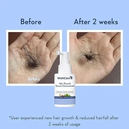 WishCare%20Hair%20Growth%20Serum%20For%20Scalp%20%7C%2094%25%20Saw%20New%20Hair%20Growth%20%7C%20Redensyl%20&%20Rosemary%20Oil%20%7C%20100%25%20Saw%20Hairfall%20Reduction%20%7C%20In-Vivo%20Tested%20%7C%20For%20Men%20&%20Women%20%7C%2030ml%20-%20Image%204