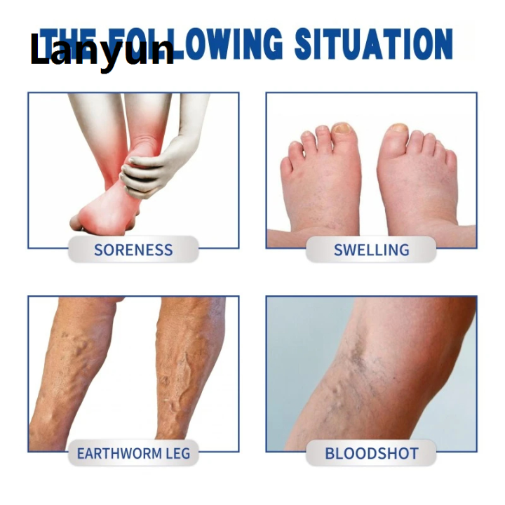 Lanyun%2020g%20Varicose%20Vein%20Relief%20Cream%20Tongmai%20Effective%20Relieves%20Leg%20Bulge%20Portable%20Pain%20Plant%20Extracts%20Treatment%20and%20Repair%20Cream%20Skin%20Care%20-%20Image%205