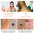 Painless Safe Skin Tag Remove Device Kit Micro Tags Sized(2mm to 4mm) Warts Remover Original Skin Band Tool Set. 