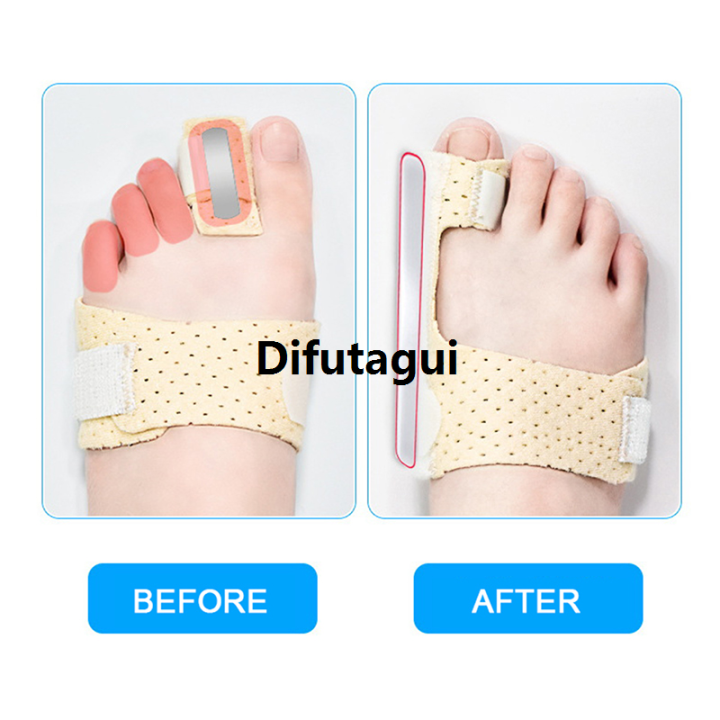 Difutagui%201PC%20Adjustable%20Hammer%20Toe%20Straightener%20Corrector%20For%20Metatarsalgia%202025%20New%20Claw%20Toe%20Mallet%20Toe%20Pain%20Relief%20Splint%20Foot%20Compression%20Wrap%20-%20Image%205