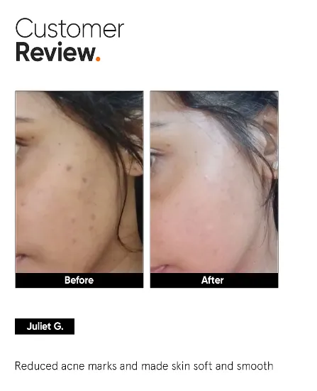 Minimalist%205%25%20Niacinamide%20Face%20Serum%20for%20Clear%20Glowing%20Skin,%20Reduces%20Dullness,%20Hydrates%20&%20Repairs%20Skin%20%7C%2030%20ml%20-%20Image%206