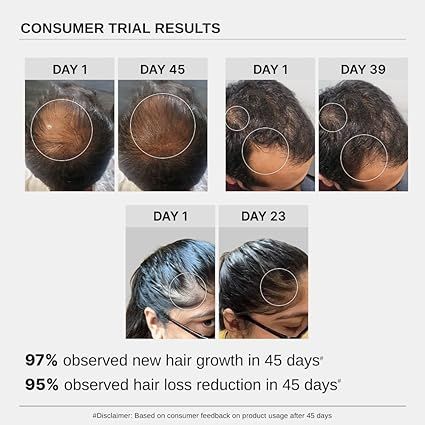 Bare%20Anatomy%20Advanced%20Hair%20Growth%20Serum%20%7C%203%25%20Redensyl%20+%204%25%20Anagain%20+%203%25%20Baicapil%20+%201%25%20Capilia%20Longa,%20Rosemary,%20Biotin%20&%20Rice%20Extract%20%7C%20Thick%20Density%20%7C%20Hair%20growth%20&%20Hair%20fall%20control%20serum%20for%20Women%20&%20Men%20%7C%2030mL%20-%20Image%208