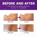 1Roll Professional Silicone Scar Sheets (Scar Tape - 150cm) Scars Treatment - Reusable Silicone Scar Strips Type for Keloid,Burn. 