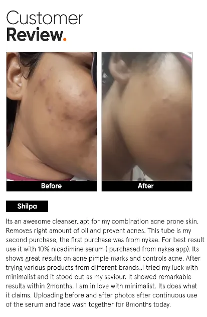 Minimalist%202%25%20Salicylic%20Acid%20Face%20Wash%20for%20Oily,%20Acne%20Prone%20Skin%20%7C%20,%20Anti%20Acne%20Face%20Cleanser%20With%20LHA%20&%20Zinc%20%7C%20For%20Women%20&%20Men%20%7C%20100%20ml%20-%20Image%205