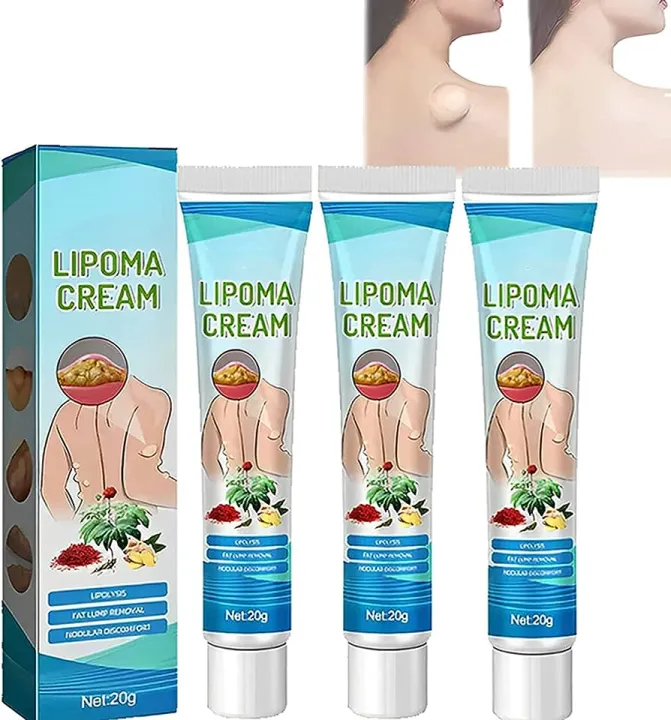 South%20Moon%20LumpFree%20Lipoma%20Removal%20Cream%20And%20Moisturizers-20g%20-%20Image%203