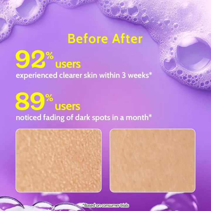 Chemis%20At%20Play%20Brightening%20Vitamin%20C%20Face%20Wash%20%7C%2030x%20Vitamin%20C%20%7C%20Removes%20Oil%20&%20Dirt%20%7C%20Fades%20Dark%20Spots%20&%20Tan%20%7C%20Boosts%20Glow%20%7C%20Soap-Free%20Cleanser%20%7C%20All%20Skin%20Types%20%7C%20For%20Men%20&%20Women%20%7C%20100%20ml%20-%20Image%204